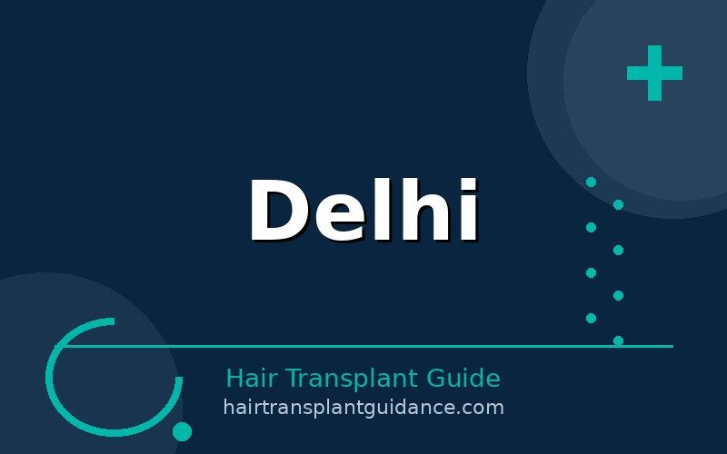 Delhi hair transplant guide