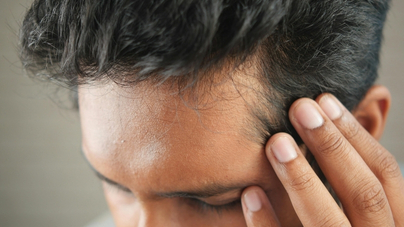 Hair Transplant Ka Kharcha — Cost in India