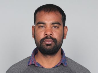 Noida hair transplant before surgery photo