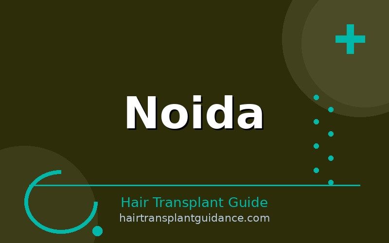 Noida hair transplant guide