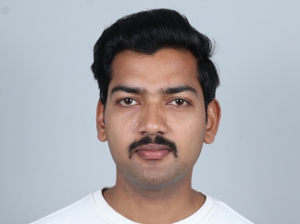 Surat hair transplant final result 12 months