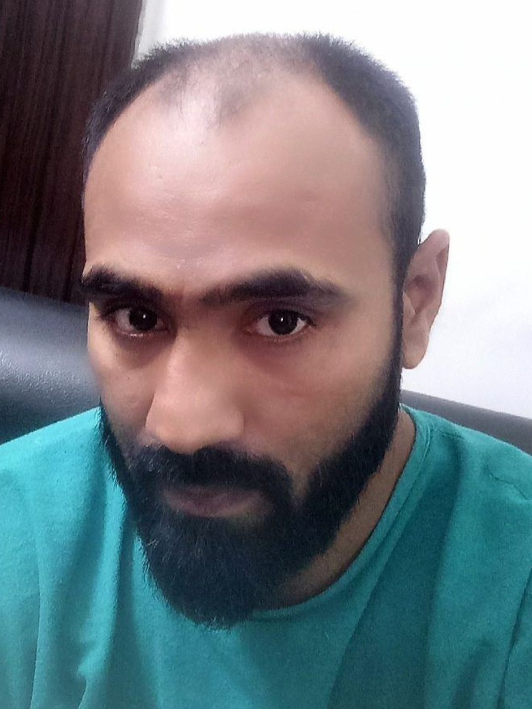 Before the procedure