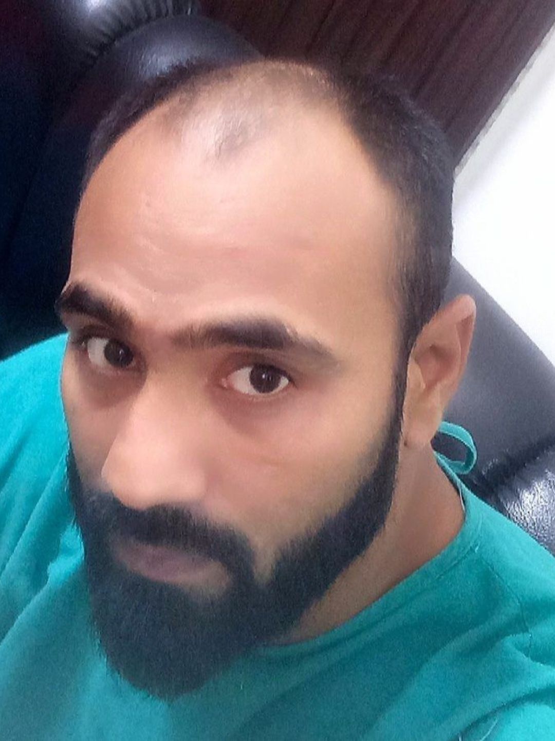 Before the procedure